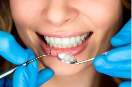 Ортопедия, протезирование зубов